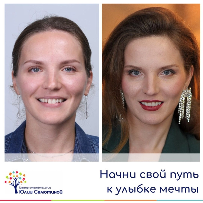 Путь к улыбке мечты 