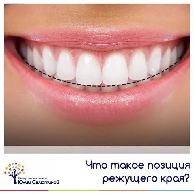 Что такое "позиция режущего края"? 
