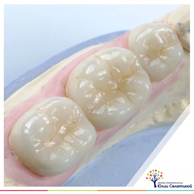 Все о коронках на зубы 