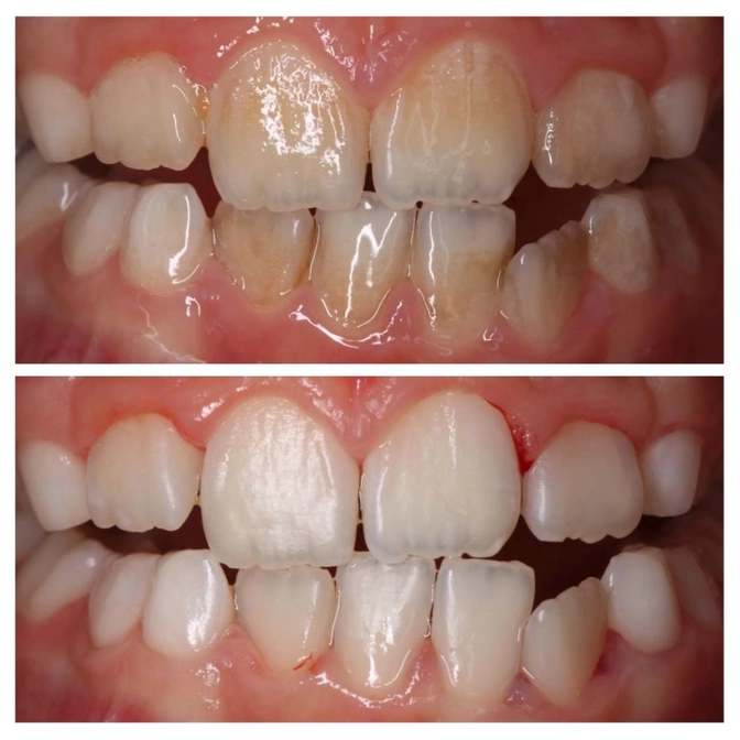 Правила длмашннй гигиены для детей 