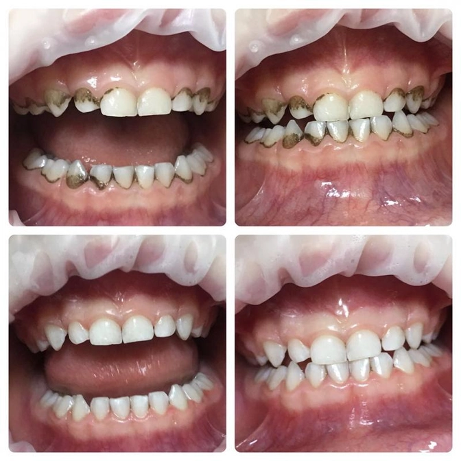 Налет Пристли 