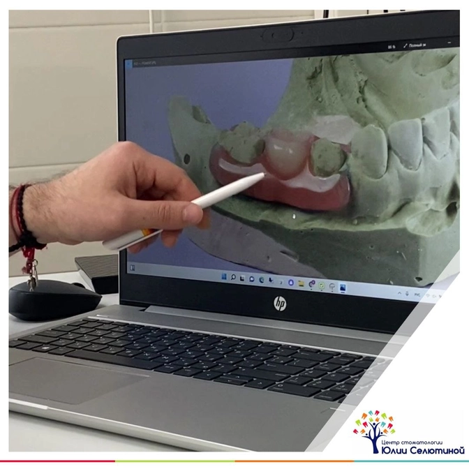 Как держать место, если зуб утерян слишком рано? 