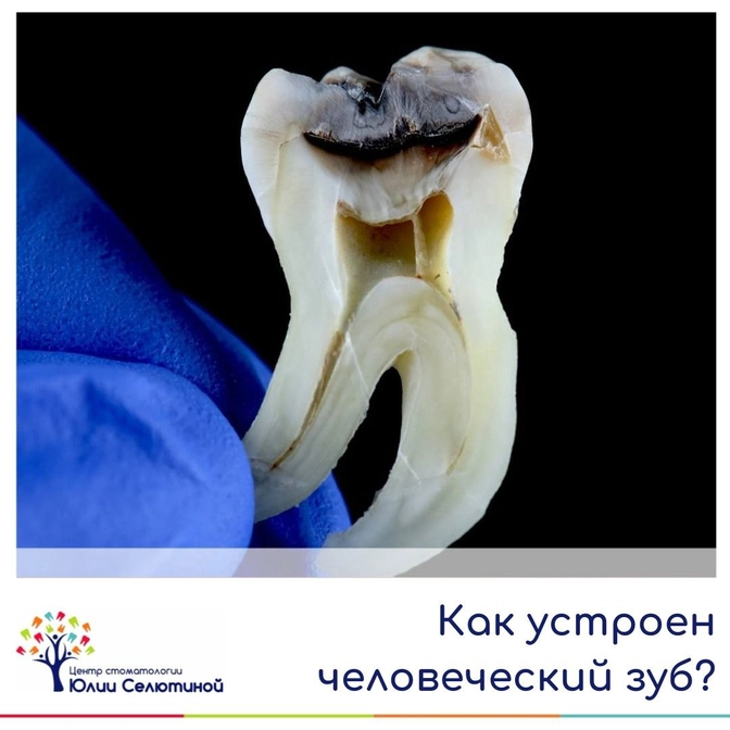 Как устроен человеческий зуб? 