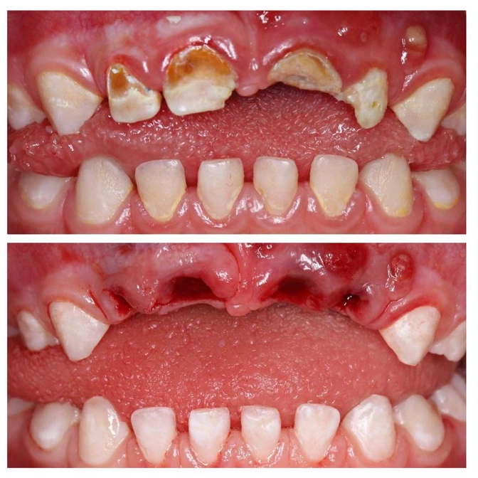 Эстетика или здоровье? 