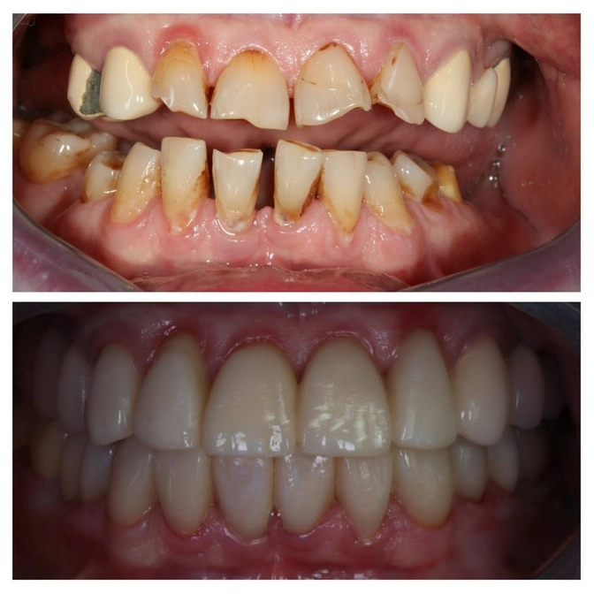 Тотальная реабилитация: сложный клинический случай с междисциплинарным подходом 