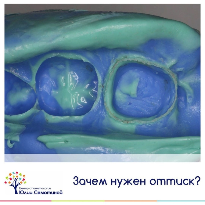 Зачем нужен слепок? 