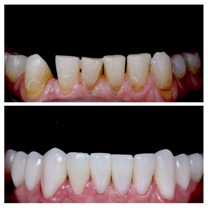 Комплексная реабилитация улыбки