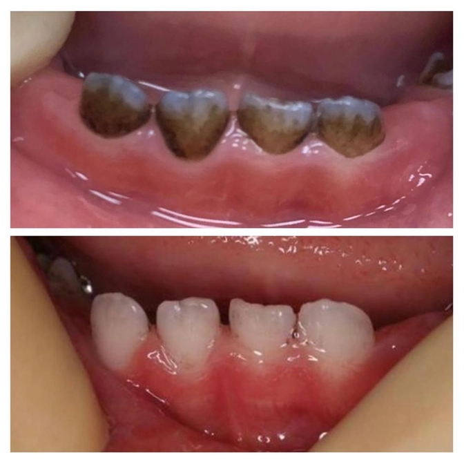 Клинический случай: актуален ли наркоз? 