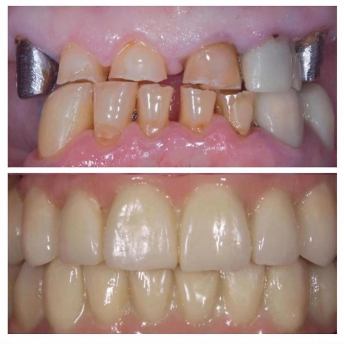 Комплексное лечение - клинический случай.