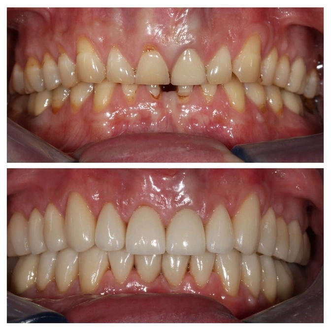 Мигрень и зубы: в чем связь? 