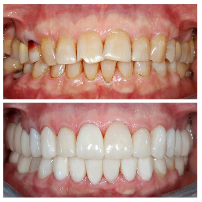 Тотальная реабилитация и избавление от мигреней 