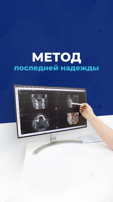 Метод последней надежды