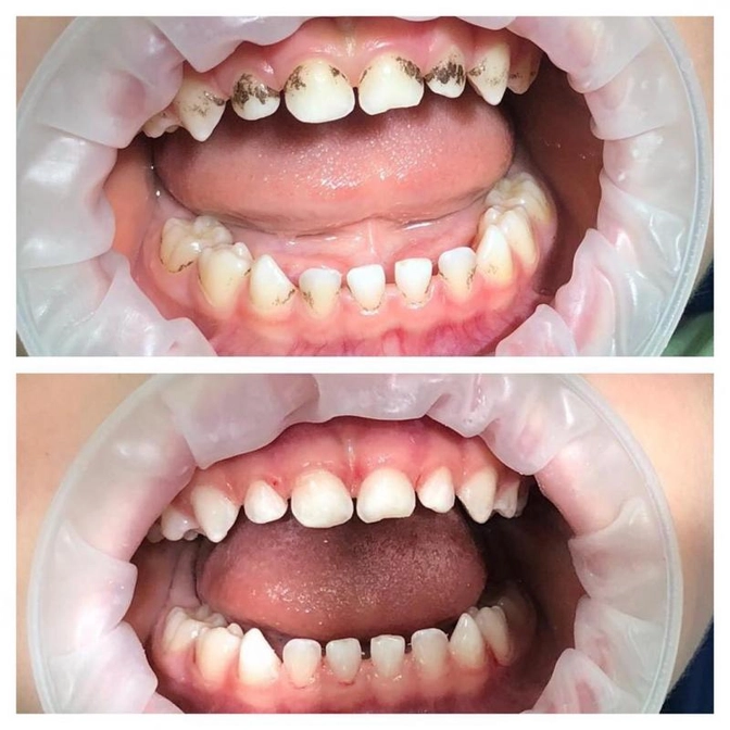 Налёт Пристли.