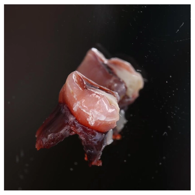 Причины окрашивания зубов в розовый цвет