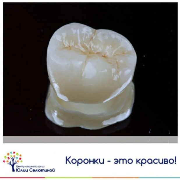 Безметалловые коронки - эстетичная стоматология. 