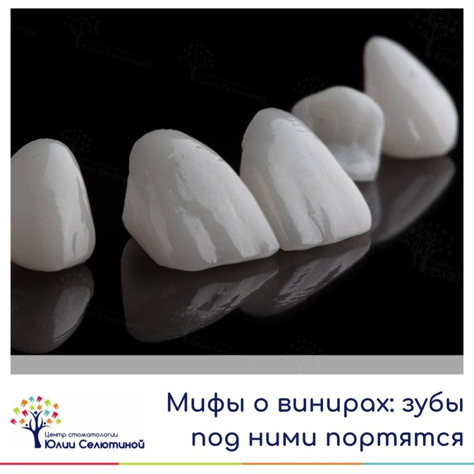 Мифы про виниры: зубы под винирами портятся? 