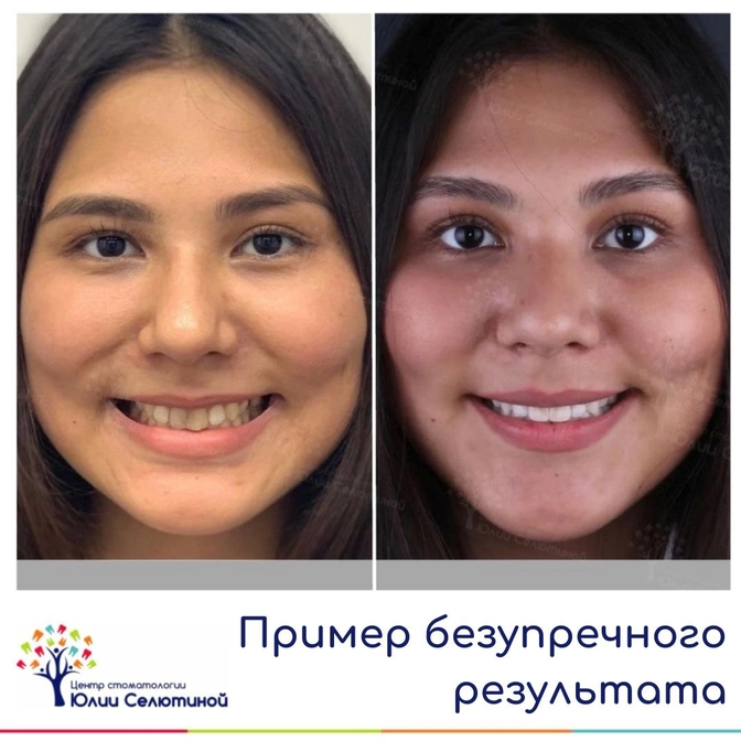 Пример безупречного результата 