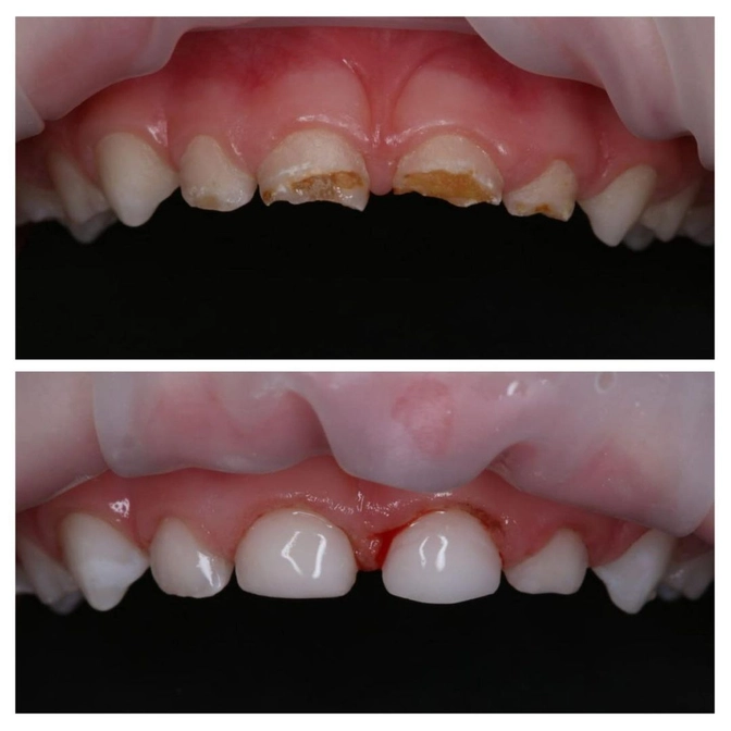 Лечение ребенка под наркозом 