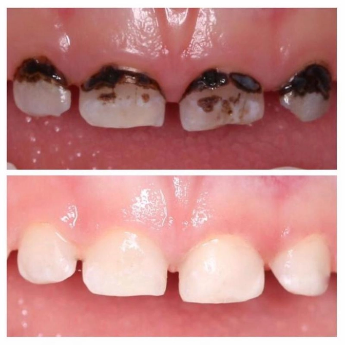 Актуально ли серебрение?