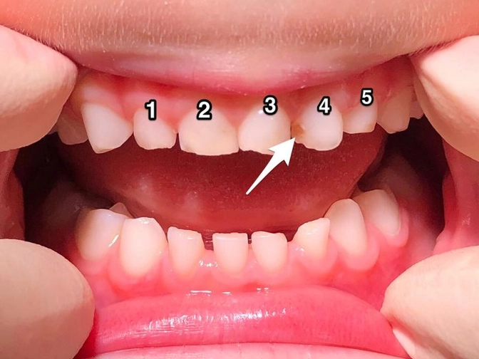Стоматологическая задача.