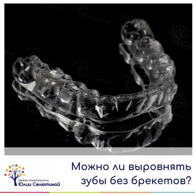 Можно ли выровнять зубы без брекетов? 