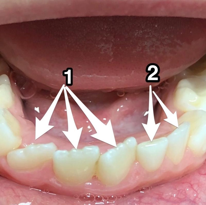Когда нужен ортодонт.