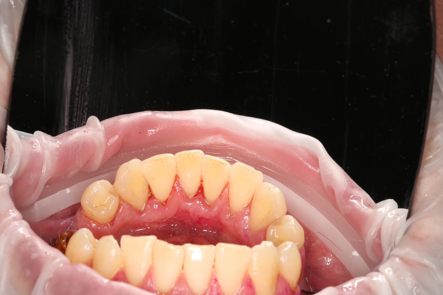 Изображение зубов после выполненой работы