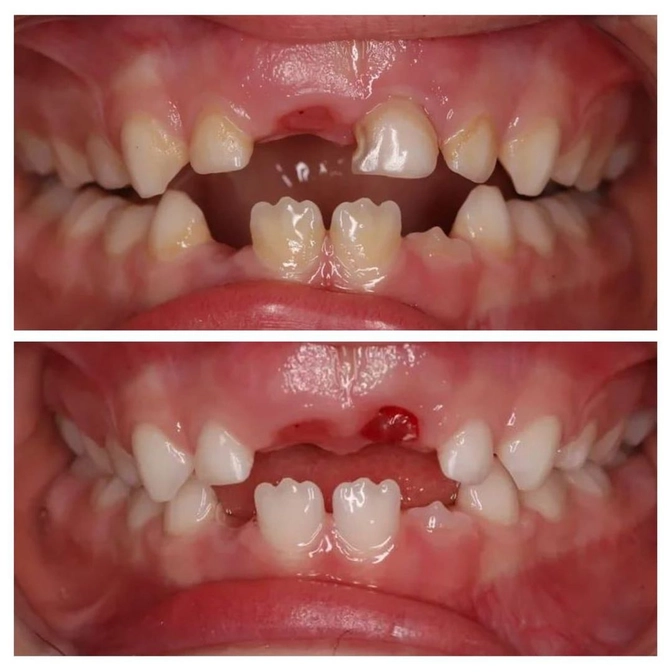 Правила домашней гигиены полости рта 