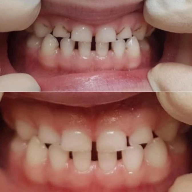 Клинический случай: Налёт Пристли