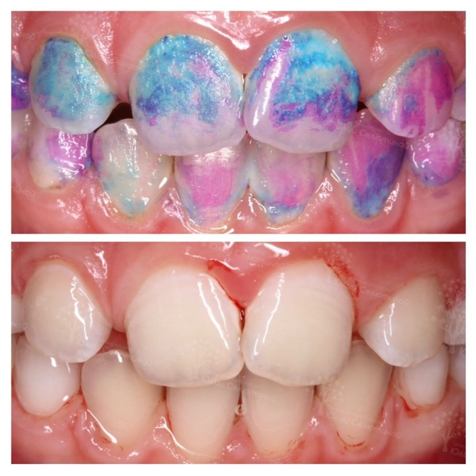 Как проверить качество домашней гигиены. 