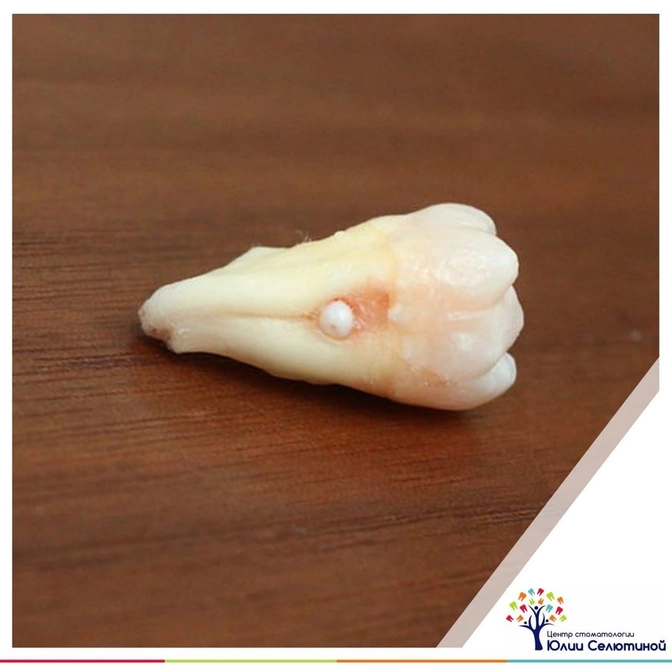 "Эмалевые жемчужины"