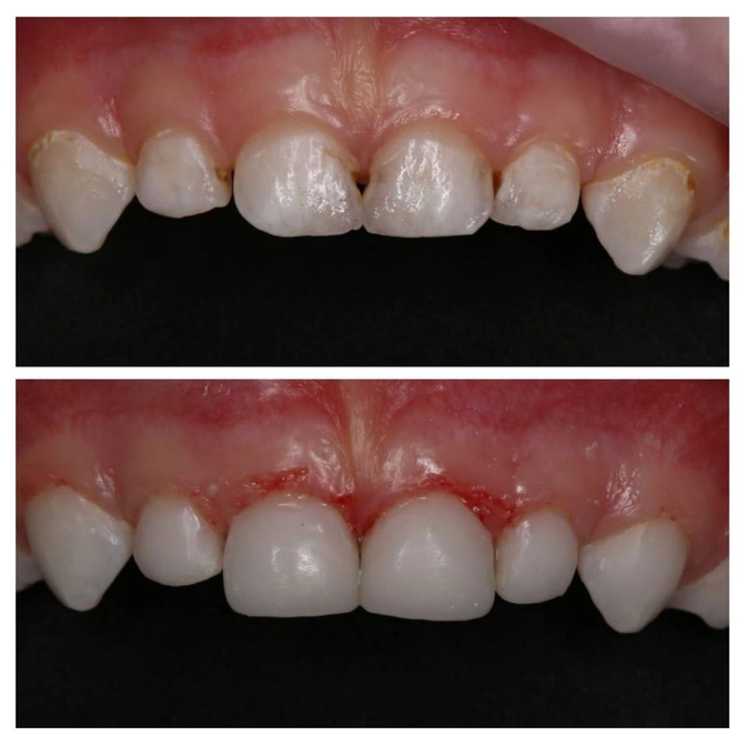 Лечение малыша под наркозом 