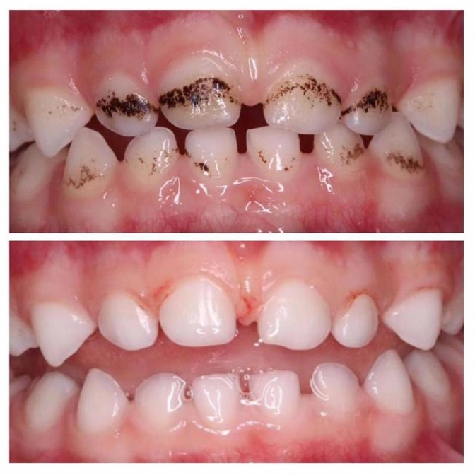 Налет Пристли - что делать?