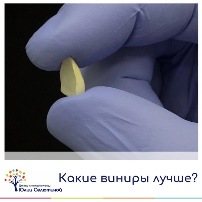 Какие виниры лучше?