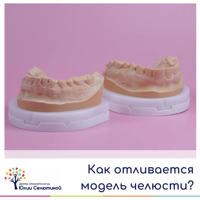 Как отливается модель челюсти? 