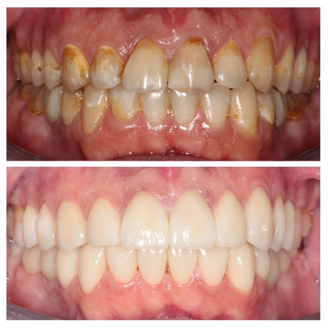 Ортопедическая реабилитация пациента. 