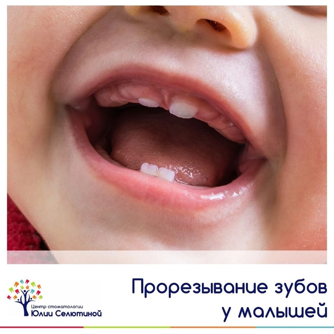 Первая помощь при прорезывании зубов 