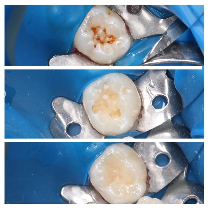 Важность адаптации ребенка на первом приеме.