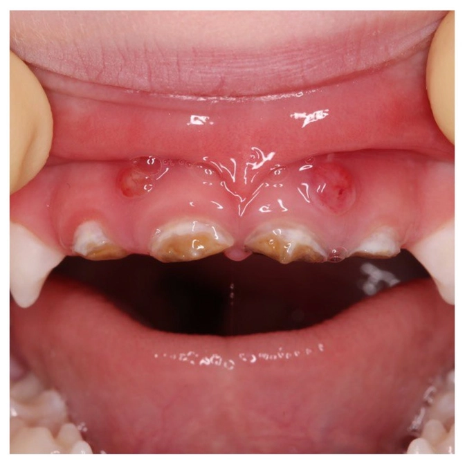 О важности рентген-диагностики! 