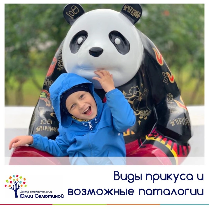 Виды неправильного прикуса