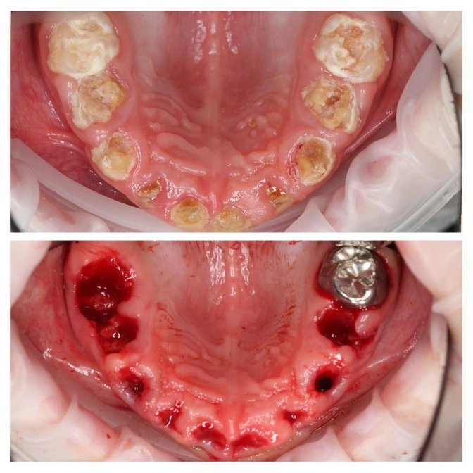 Почему важно чистить зубы детям? 