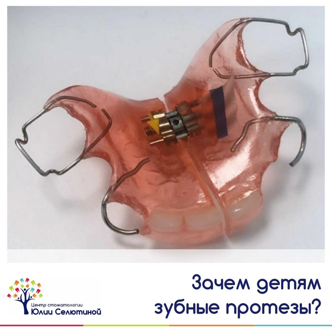 Зубные протезы для детей. 