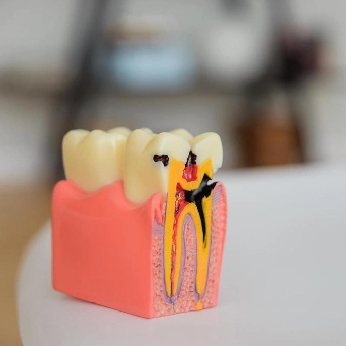 Пульпит - что это?