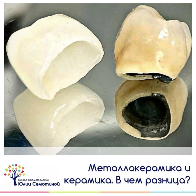 Какую коронку выбрать? 