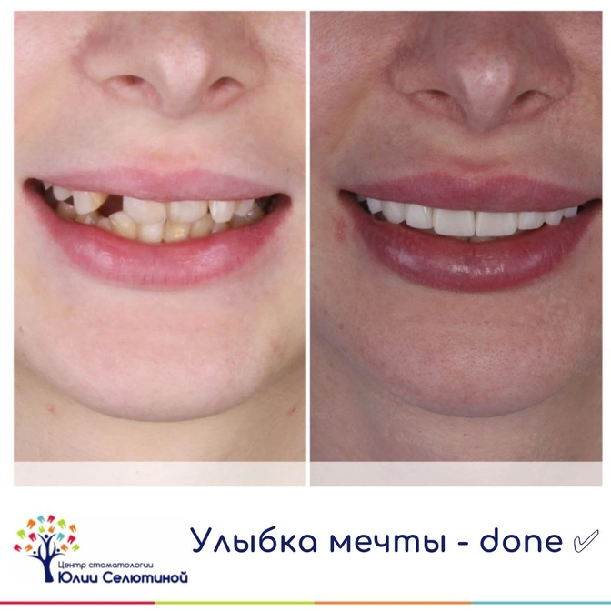 Улыбка мечты 
