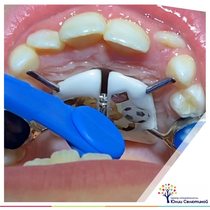 Как правильно подкручивать аппарат HAAS