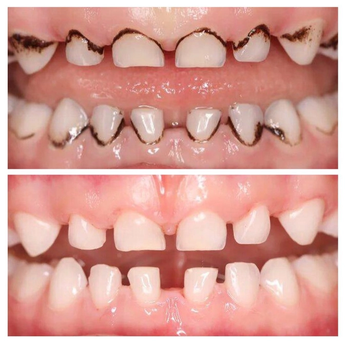 Налёт Пристли 