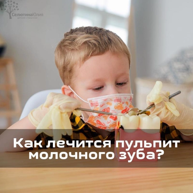 Лечение пульпита молочных зубов.