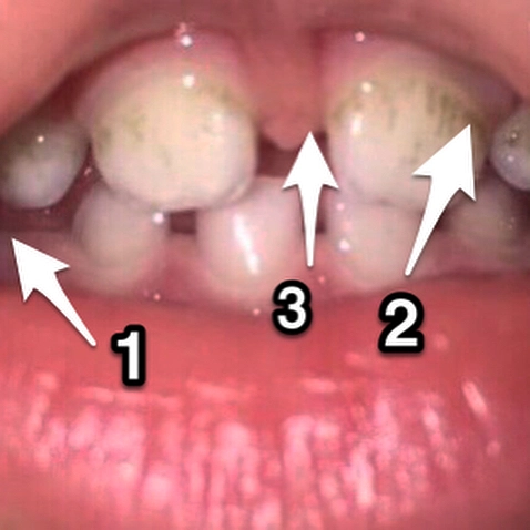 Стоматологическая задачка.