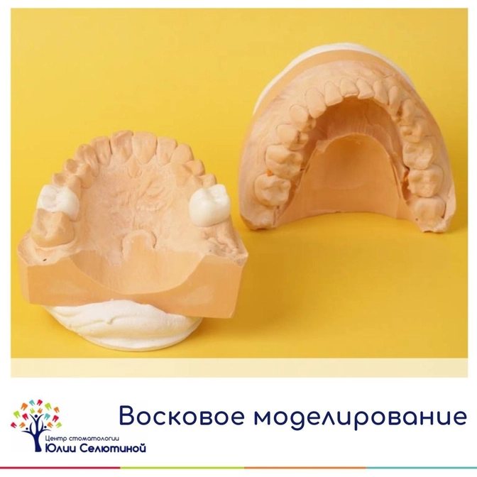 Восковое моделирование зубов 